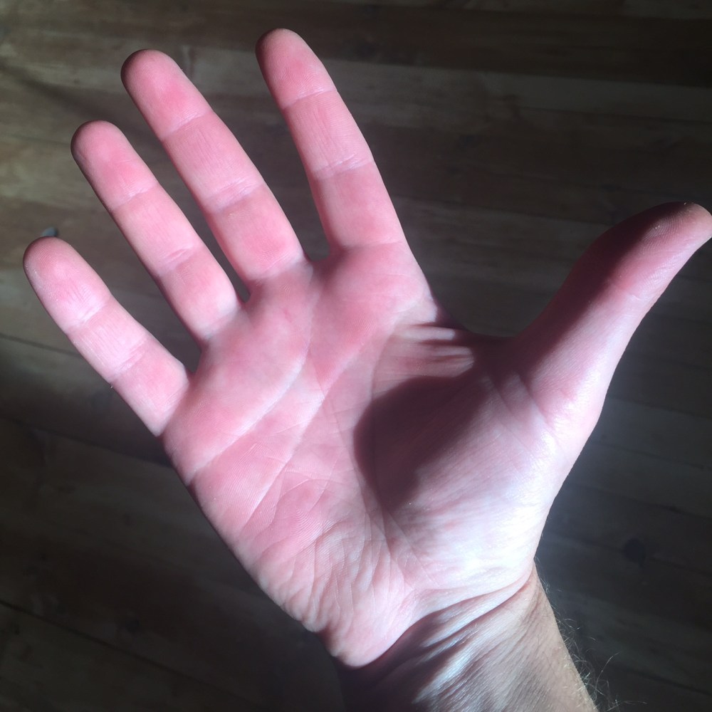 My not-so-delicate musician hands